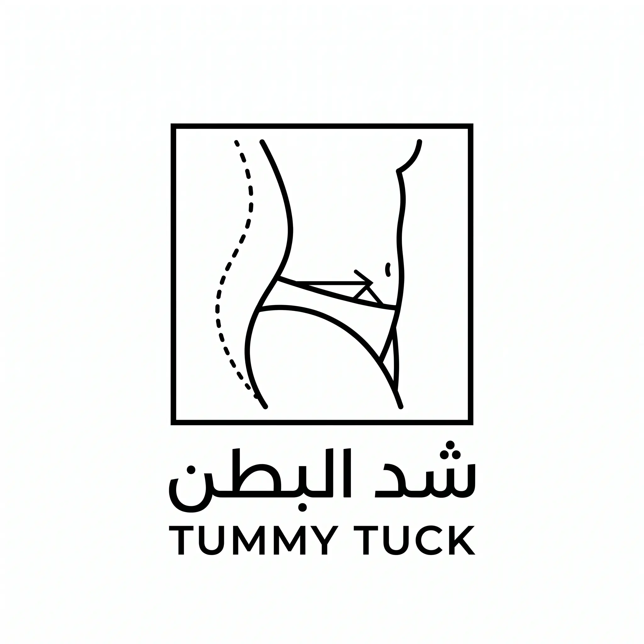Tummy Tuck