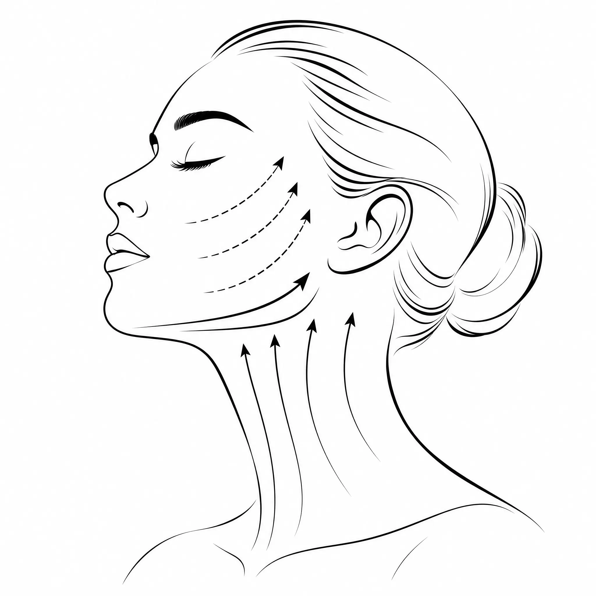 Facelift