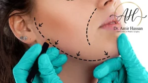 جدول زمني للتعافي بعد عمليات تجميل الوجه - د. أمير حسن